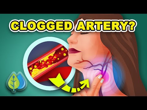 The BEST Way to Clear Out Your Arteries