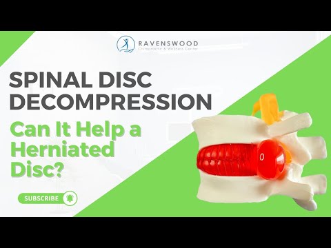 Can Spinal Decompression Help a Herniated Disc?