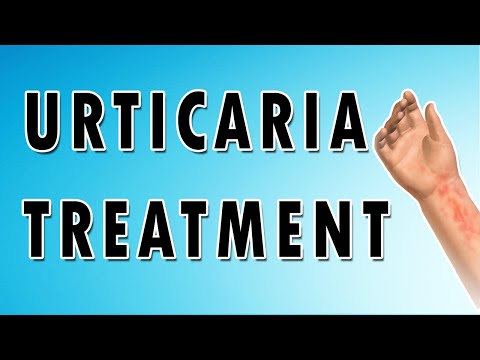 Video: Urticaria - Symptoms, Treatment, Alternative Methods