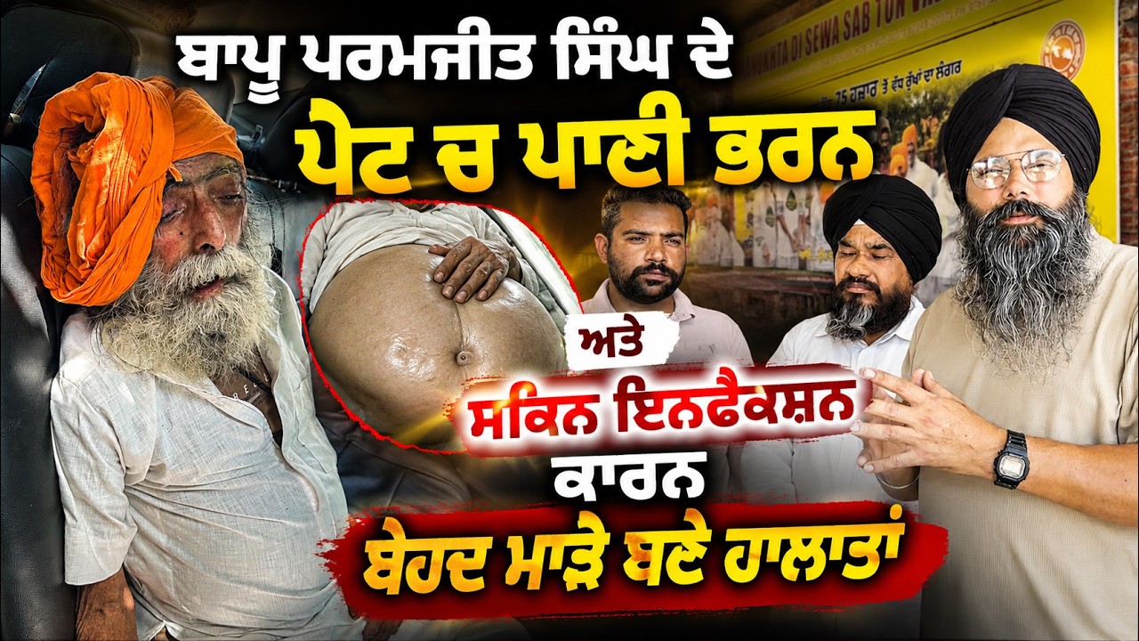 ⁣ਬਾਪੂ ਪਰਮਜੀਤ ਸਿੰਘ ਦੇ ਪੇਟ ਚ ਪਾਣੀ ਭਰਨ ਅਤੇ ਸਕਿਨ ਇਨਫੈਕਸ਼ਨ ਕਾਰਨ ਬੇਹਦ ਮਾੜੇ ਬਣੇ ਹਾਲਾਤਾਂ