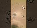 Live organism moving under the microscope