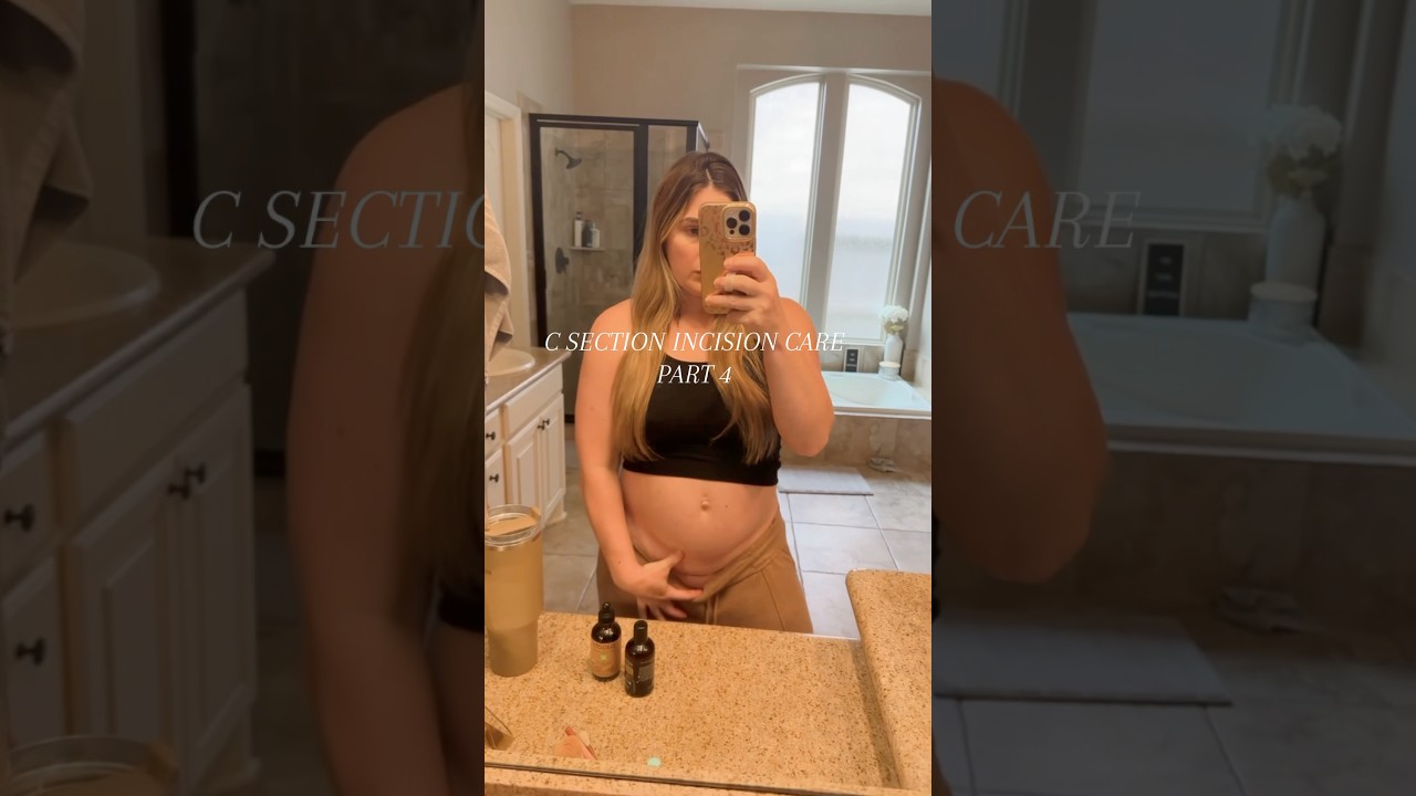 PART 4: Prepping for C Section Scar Massage + Removing surgical glue 