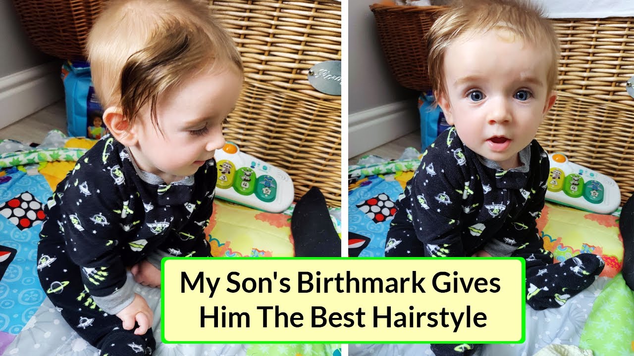 Photos Of People Who Drew Wild Cards In The Genetic Lottery