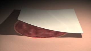 LifeNet Health- Matracell Decellularized Dermis screenshot 4