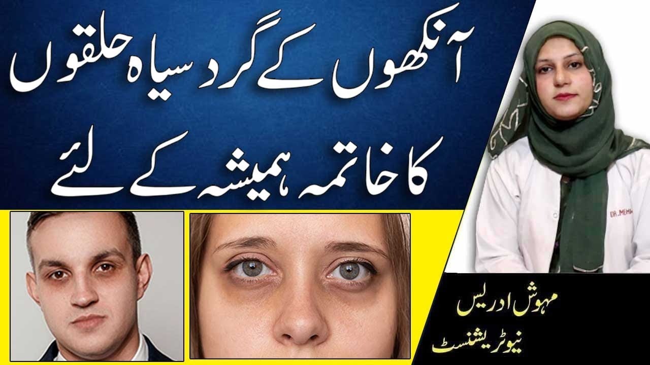 How To Treat Under Eyes Dark Circles Naturally In Urdu