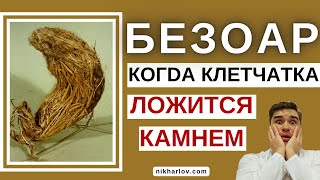 БЕЗОАР желудка и кишечника. ХУРМА ➡ ФитоБезоар. Поедание волос ➡ ТрихоБезоар. Причины, Факторы риска