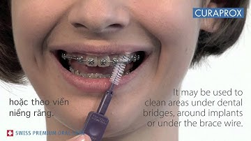 Bàn chải kẽ răng dành cho niềng răng