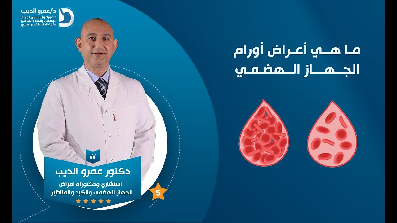 أعراض أورام الجهاز الهضمي | دكتور عمرو الديب