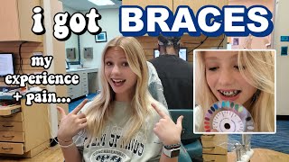 i got BRACES for the first time... *vlog*