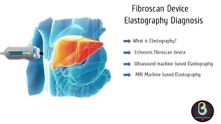 Fibroscan Device | Elastography | Biomedical Engineers TV |