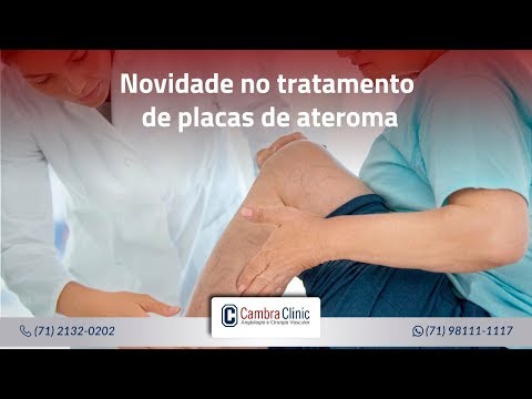 Vídeo: Tratamento De Ateroma -> Métodos Modernos