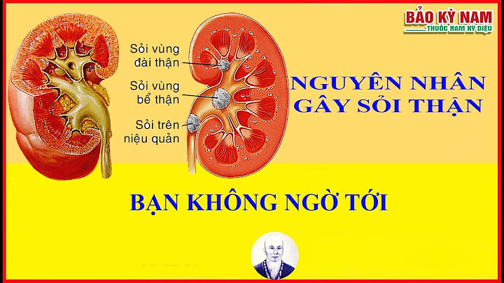 Nguyên nhân gây ra sỏi thận sinh 8