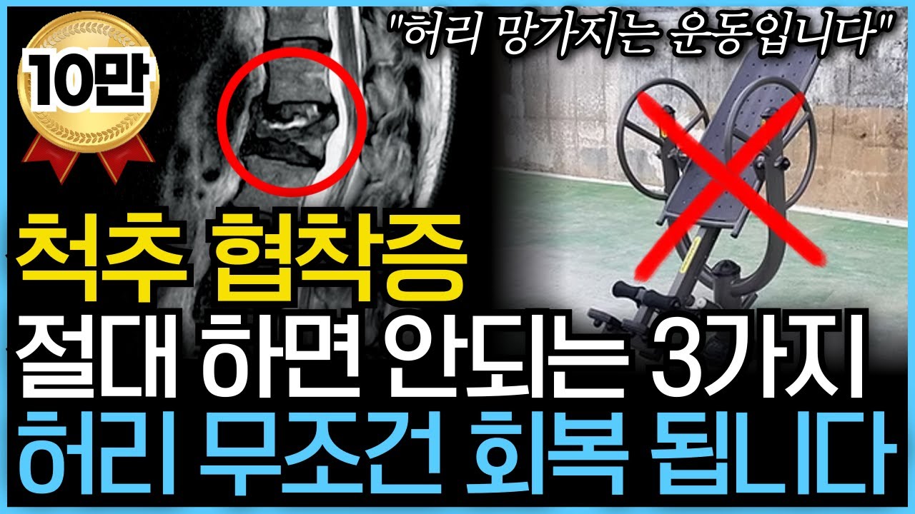 척추 협착증! 이것만 안하면 무조건 낫습니다. 허리 협착증에 하면 안되는 운동과 좋은 운동을 정형외과 전문의가 알려드립니다. (feat.허리 스트레칭, 허리디스크, 거꾸리)