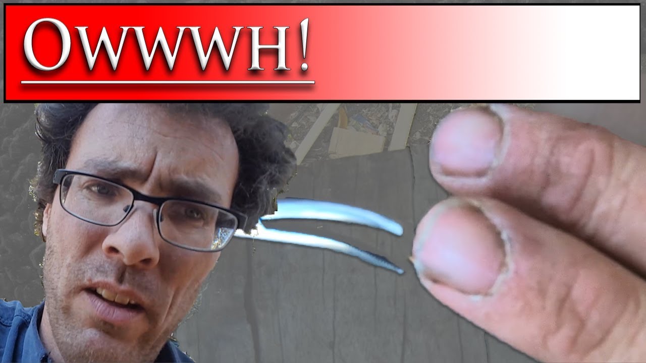 Huge Splinter under my finger nail Work Bench Surgery YouTube