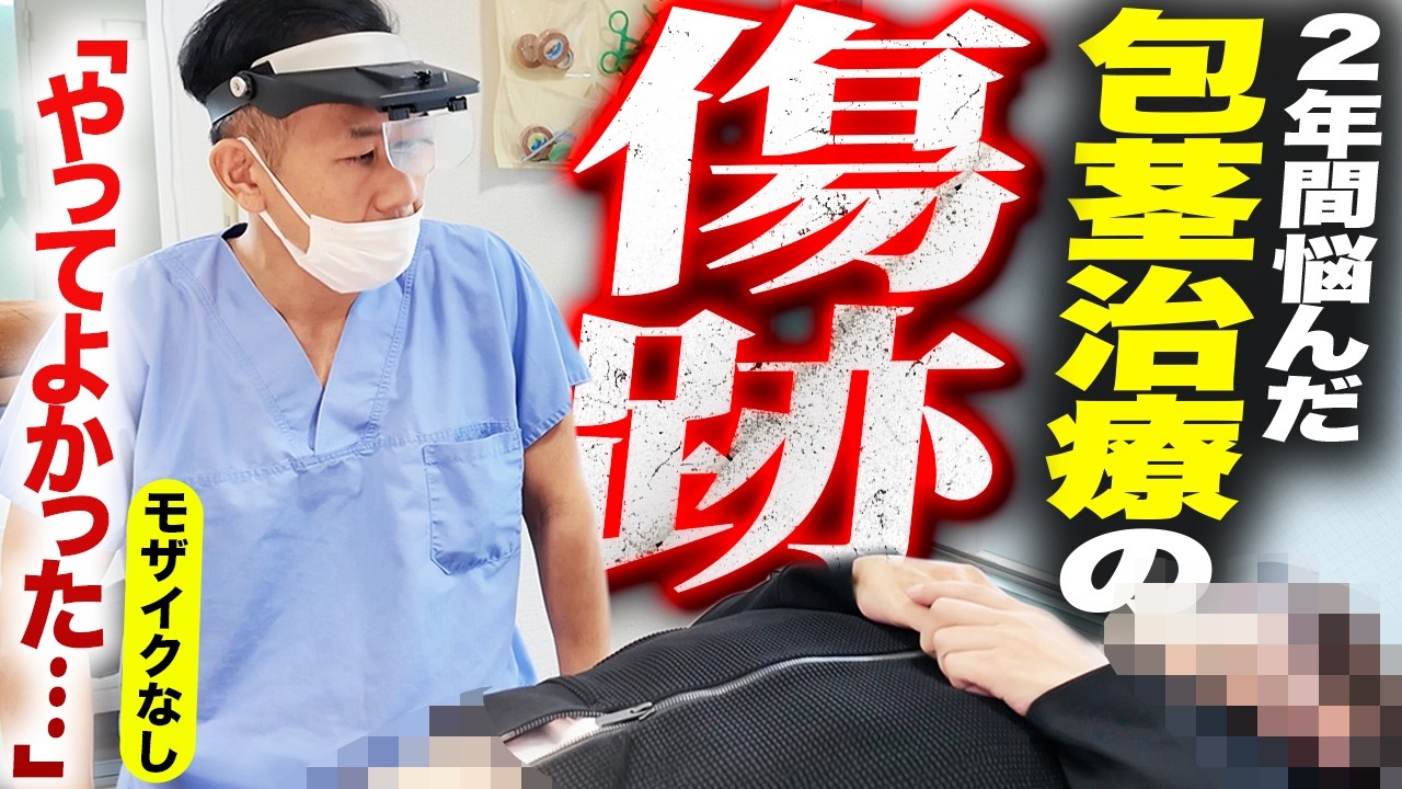 【術後2週間の本音】包茎手術後の抜糸に密着!正直、手術をした後どう感じた?【モザイクなし】