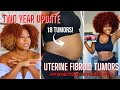 Fibroid Update Pt. 3 — 2 Years Post-Surgery Appointment, Lifestyle Updates, Resources &amp; More!