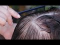 Выпадают волосы что делать? Как остановить выпадение волос в домашних условиях?
