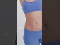 Real CoolSculpting Results | Non-Surgical Fat Reduction