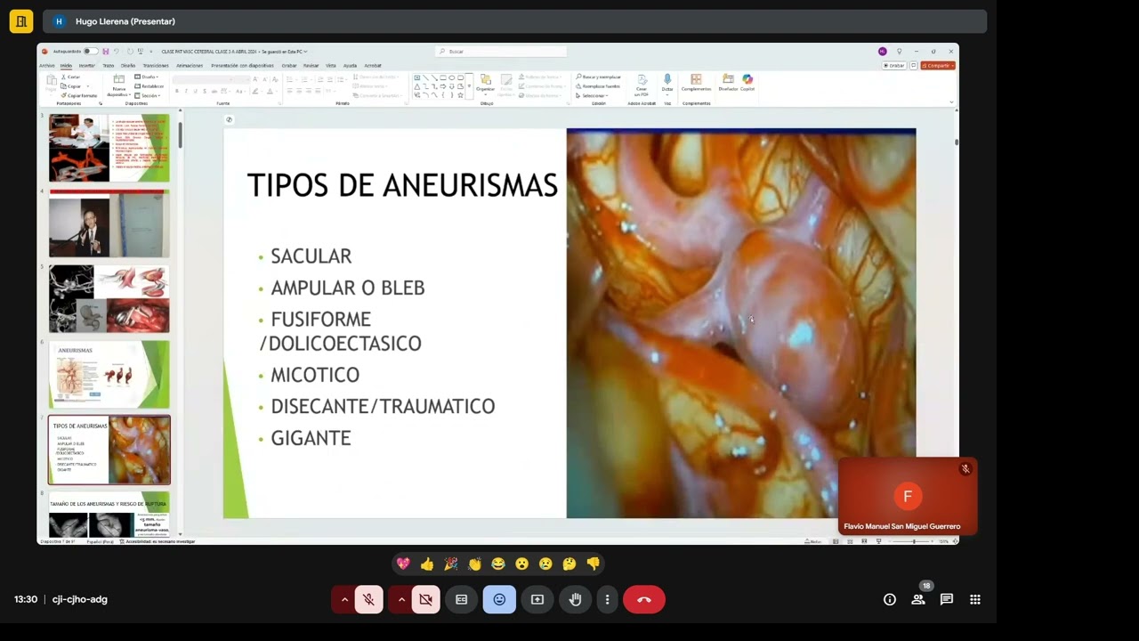 2 NEUROCIRUGÍA: Enfermedad vascular y HSA — Transcript