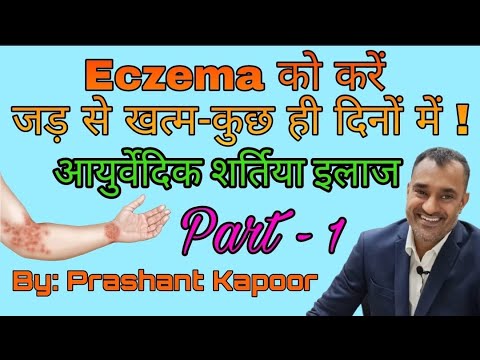 Permanent treatment for Eczema- Ayurvedic remedy | Prashant Kapoor