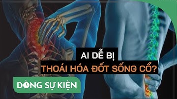 Người nào thường dễ bị thoái hóa đốt sống cổ - PLO