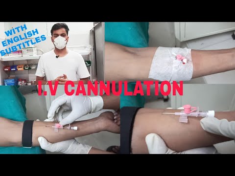 Intravenous Cannulation Technique | Iv Cannulation Procedure