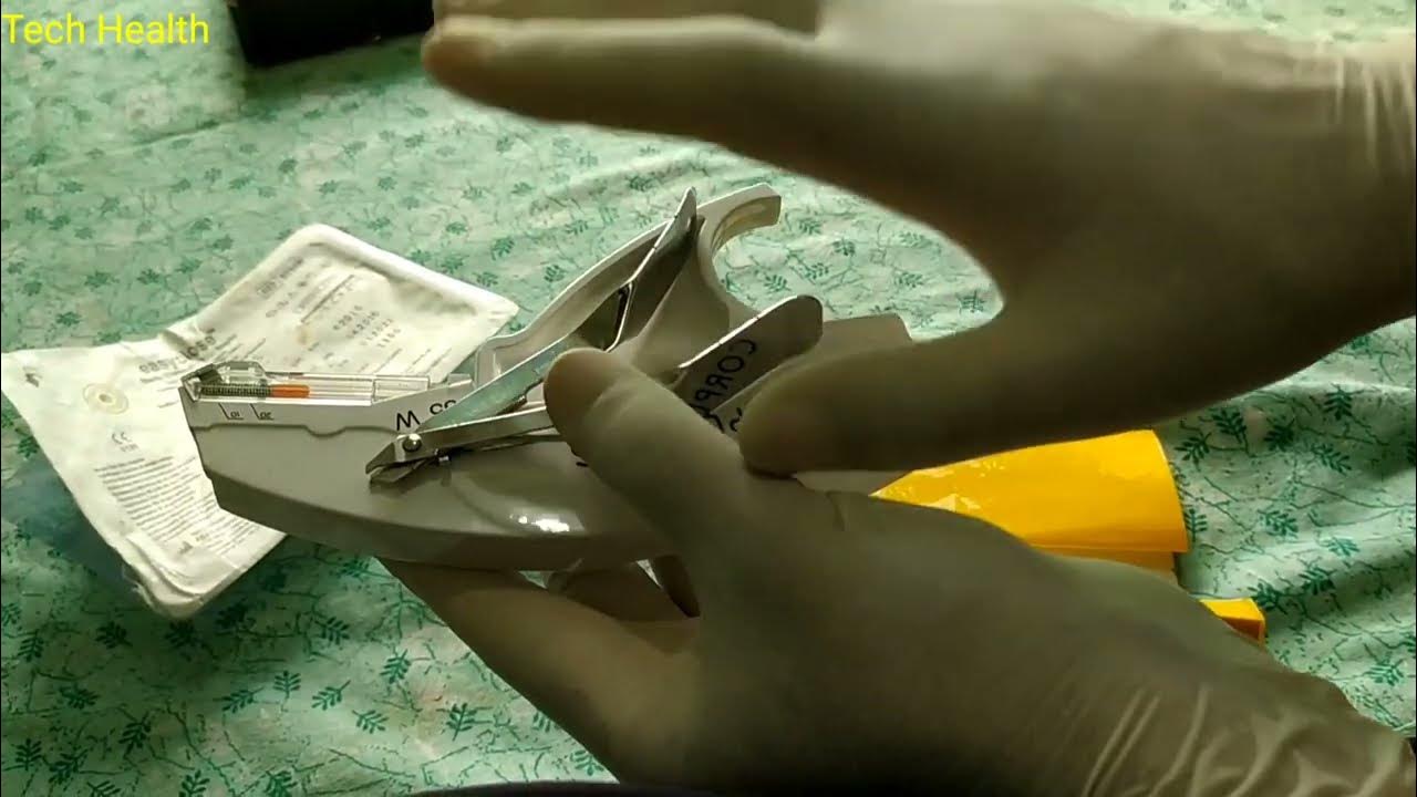 Stapler how to Use Skin Stapler Procedure Skin Stapling Technique