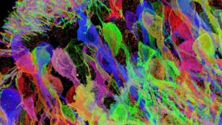 Expansion Microscopy of Brainbow Hippocampus