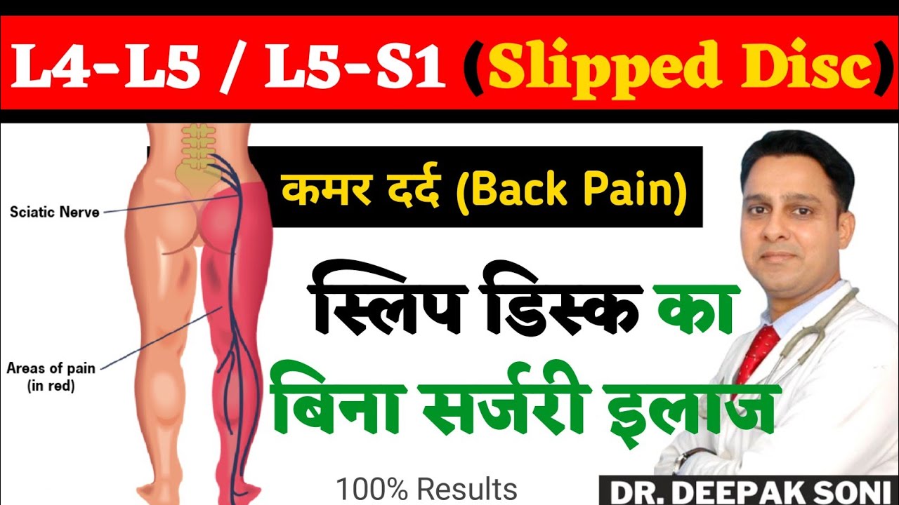 L4L5/ L5S1 स्लिप डिस्क का बिना सर्जरी इलाज Slipped disc ka Bina