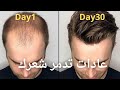 5 عادات تدمر شعرك تجنبها الأن