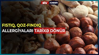 Fistiq, Qoz Findiq Allergi̇yalari Tari̇xə Dönür