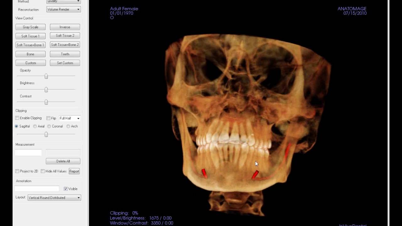 Anatomage In Vivo Viewer