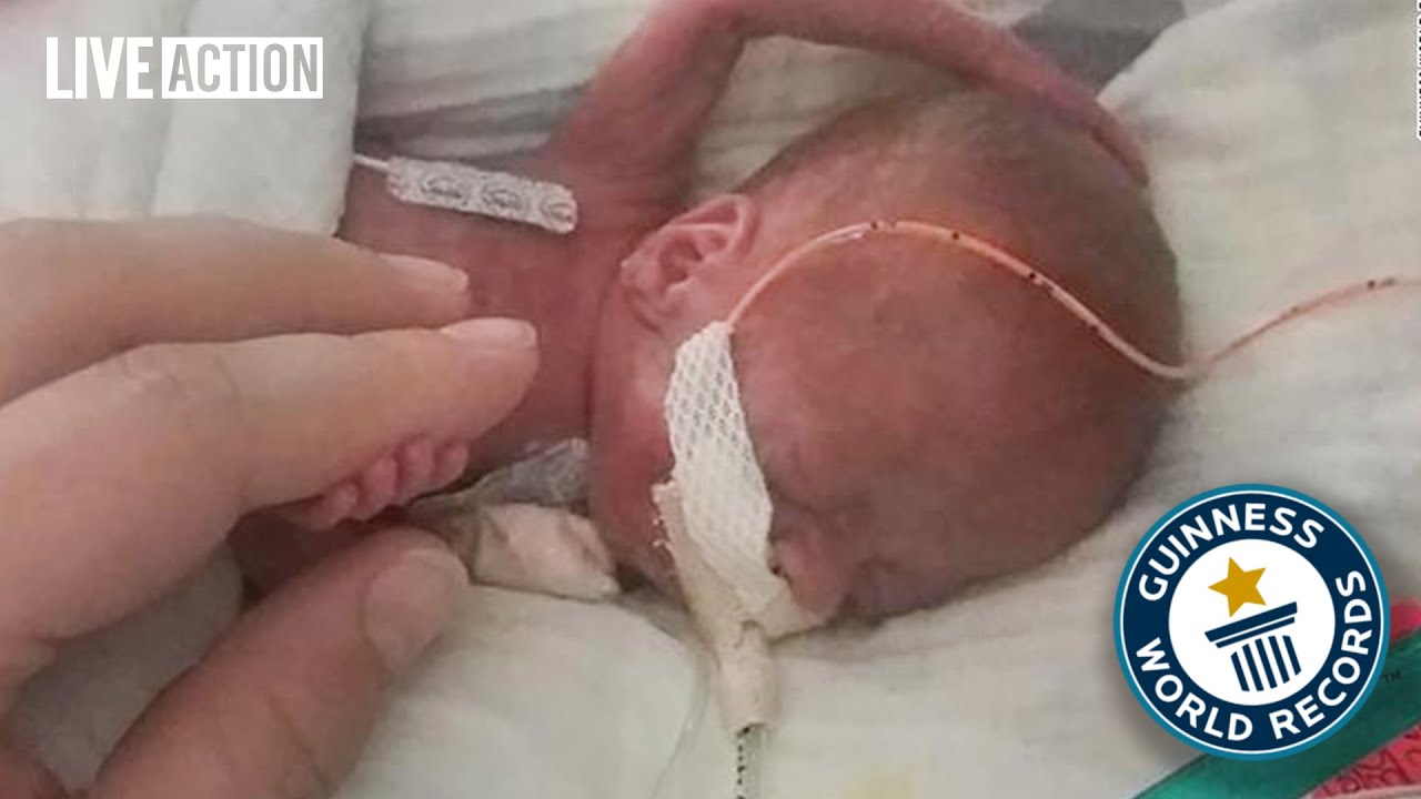 World's Smallest and Youngest Preemies