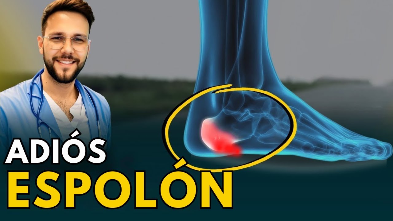 Espolones calcáneos: tratamiento en el hogar que realmente funciona