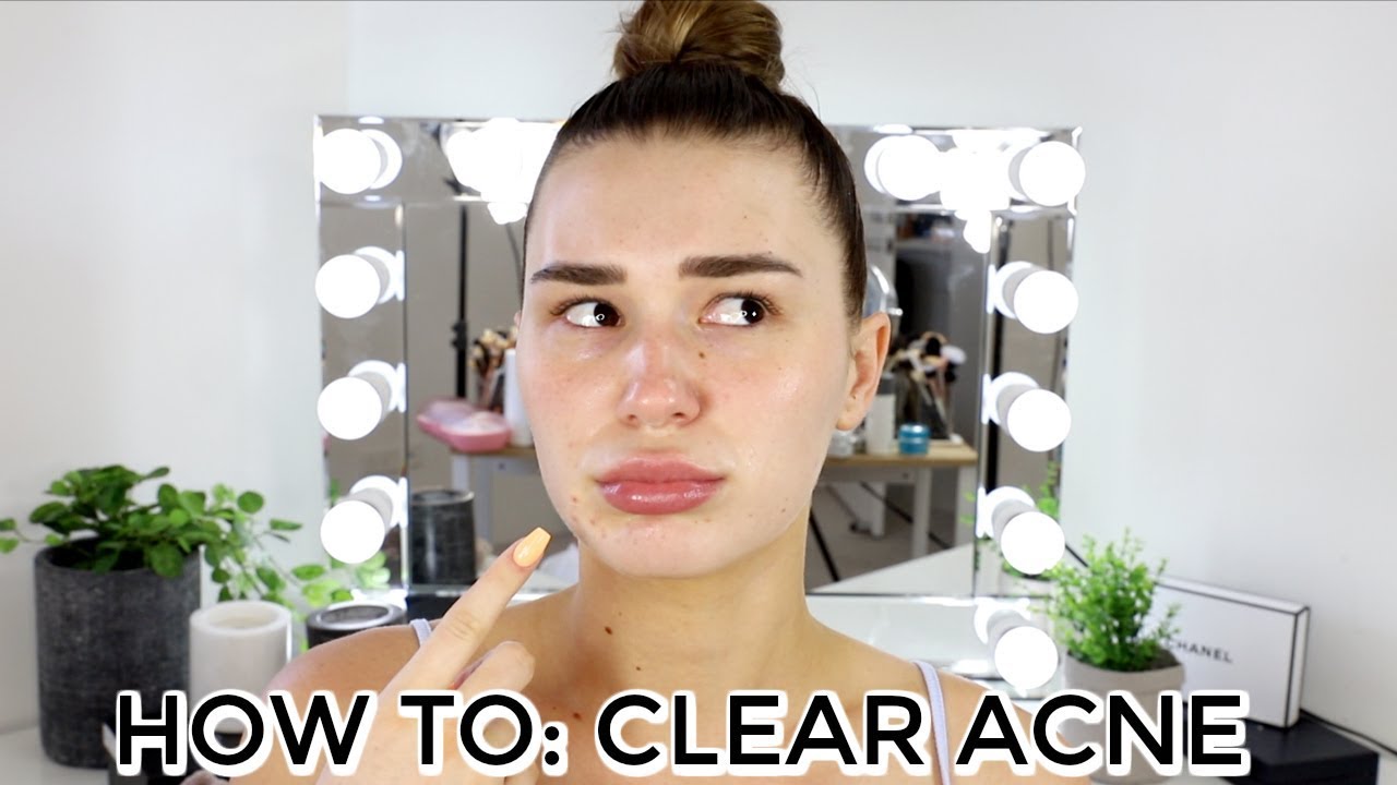 9 things to try when acne won't clear - American Academy of Dermatology