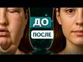 Замучили отеки на лице — пора разгонять лимфу!