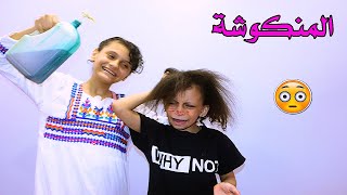 اختى الصغيرة شعرها منكوش