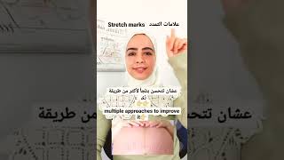 الخطوط الحمراء والبيضاء في الجسم (علامات التمدد - Stretch Marks )