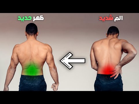 Get rid of lower back pain permanently | Causes and treatment