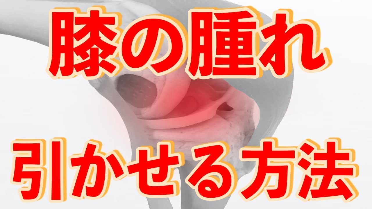 あなたの膝の腫れが引かない原因は毎日の〇〇