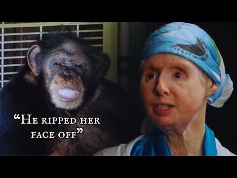 Charla Nash's Incredible Resilience: A Visual Story