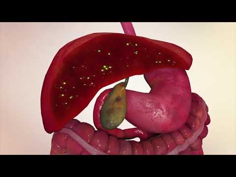 Video: Լյարդի և փայծաղի քաղցկեղ (Hemangiosarcoma) կատուներում