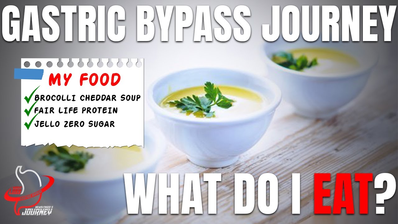 Gastric Bypass Journey | What do I eat? (*Late upload before staples remove) 