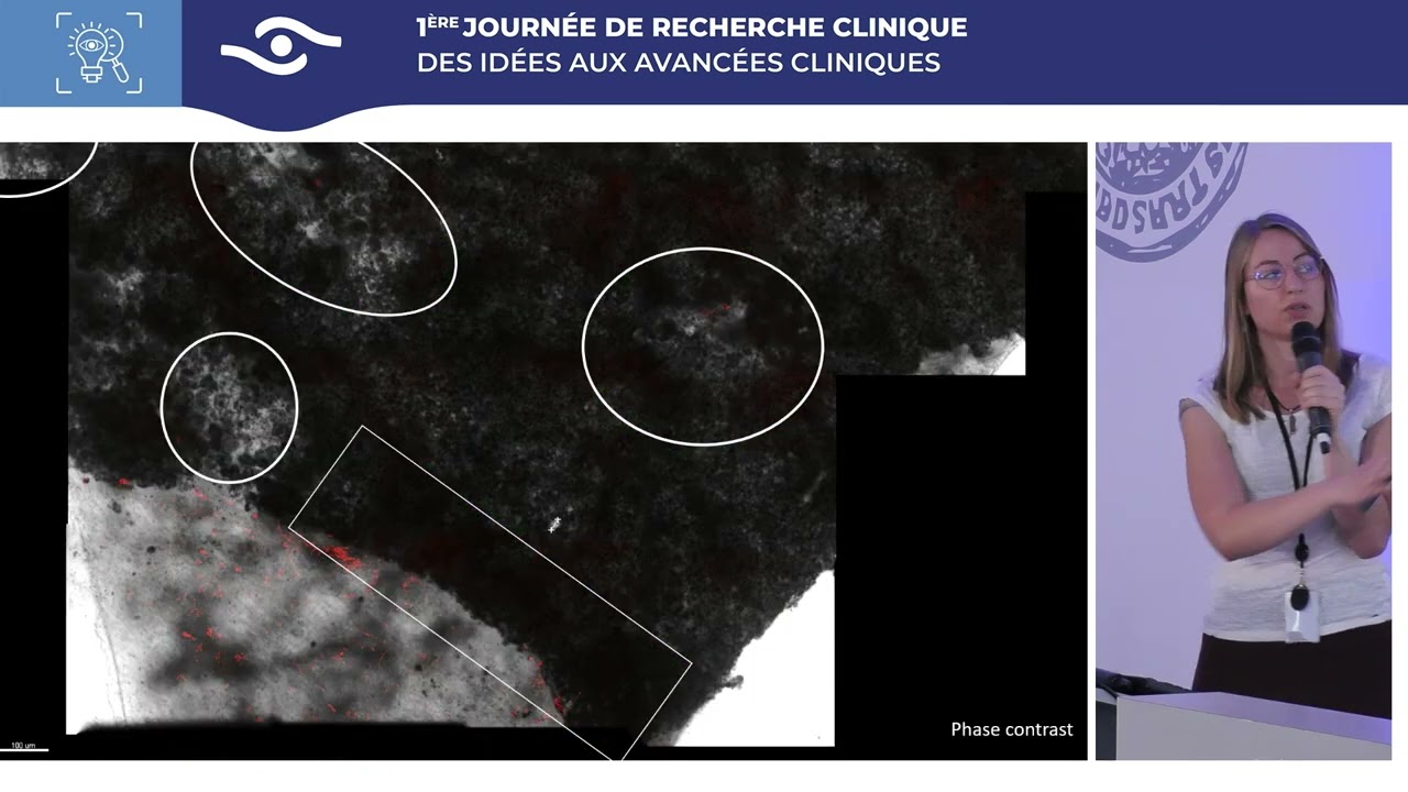 Vers une imagerie fonctionnelle ?