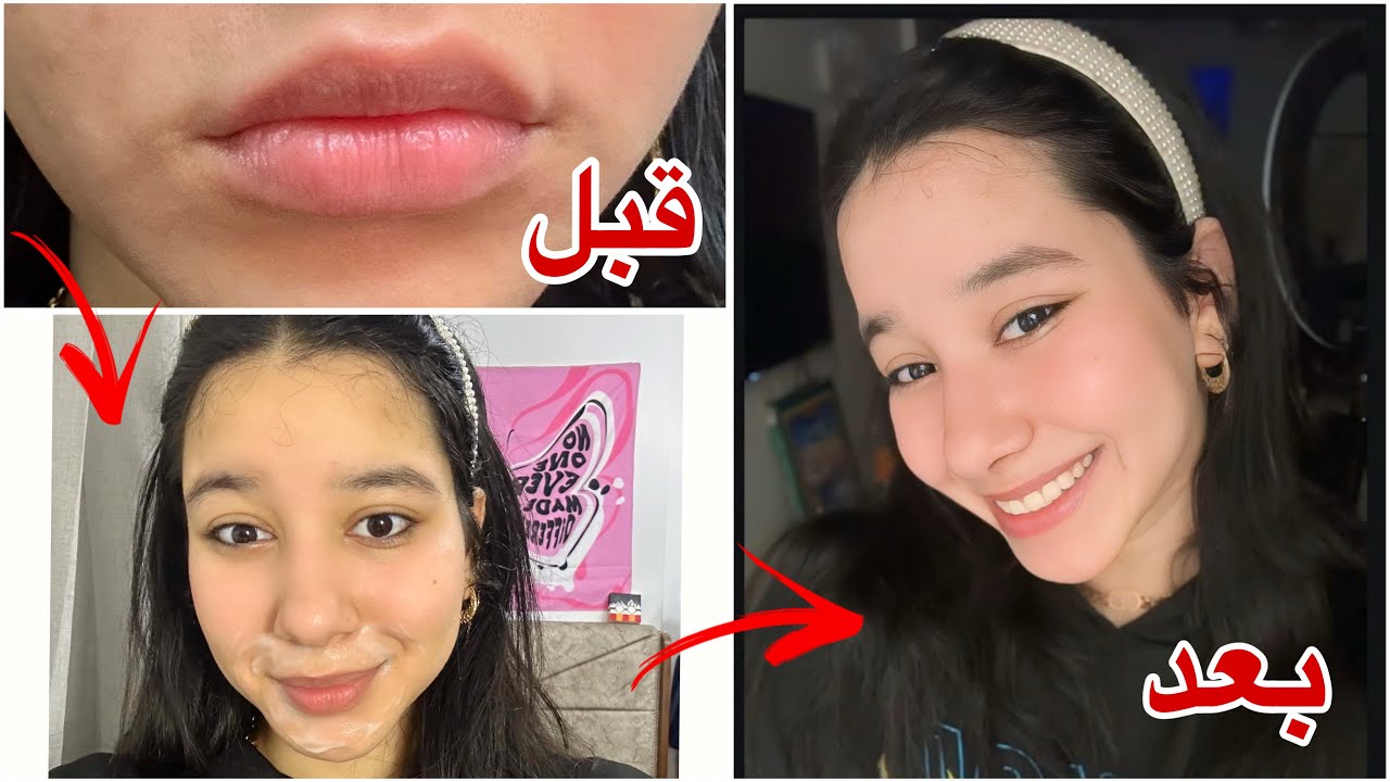 اقوي وصفة لتفتيح و الاسمرار والغمقان حول الفم 🤩 روتين كامل للعناية بمنطقة حول الفم🎀تجهيزات العيد💗🎀