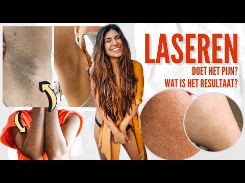 Video: 4 Redenen Om Je Scheermes Weg Te Gooien En De Laser Te Proberen