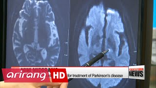 International research team grows mini midbrains from human stem cells
