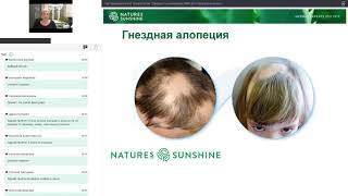 ч 2 Здоровье и уход за волосами Причины выпадения волос Продукция НСП которая для здоровья волос 