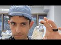 What they dont tell you about cannabis before surgery dr kaveh live