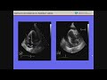 echocardiography review